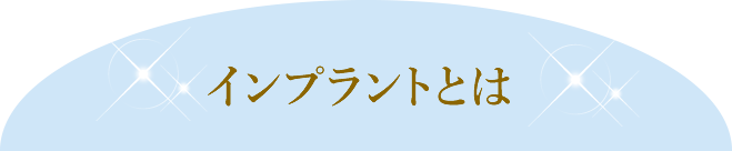 インプラントとは